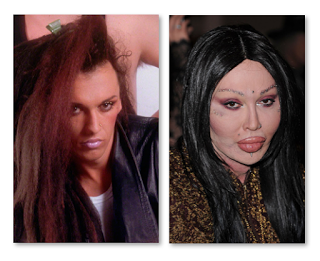 Pete Burns Before And After Plastic Surgery