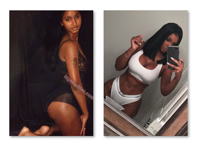 How Old Is Bernice Burgos? Before And After Plastic Surgery