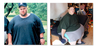 James My 600-lb Life 2017 – Update, Before And After