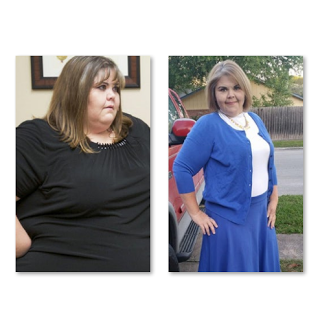 My 600 lb Life Zsalynn – Before And After