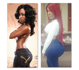 K. Michelle Before And After – Plastic Surgery
