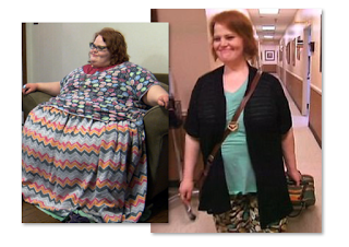 My 600 lb Life Before And After Pics