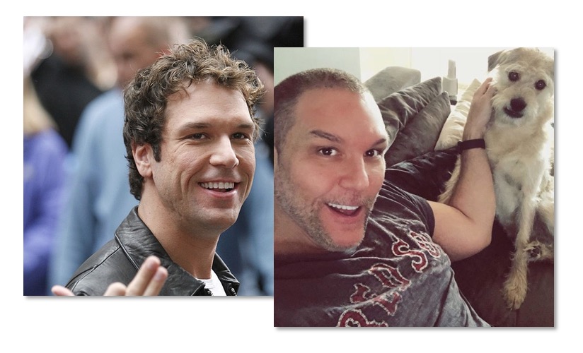 Dane Cook Plastic Surgery: Before And After Pics