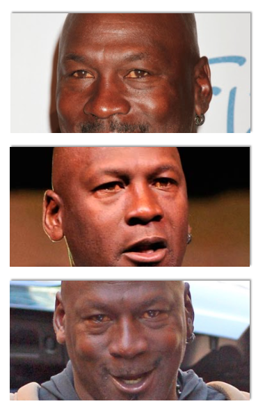 Why Are Michael Jordan’s Eyes Yellow? Red? Liver Disease?